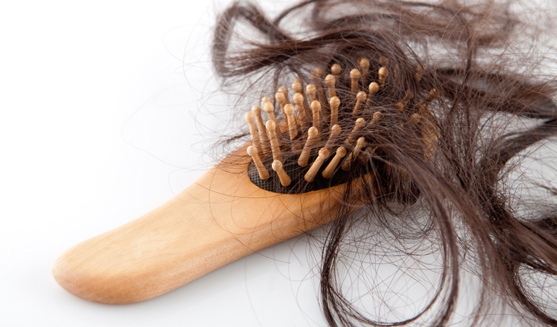 Hair Loss - Nu.Reflections: Medical Aesthetics